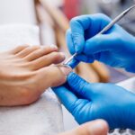 SINTRADISPENSE oferece convênio para serviços de Podologia